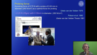 Dr.弘岡に訊く臨床的ペリオ講座 スカンジナビアンアプローチの実際